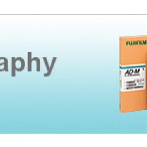 ad mamograpi system